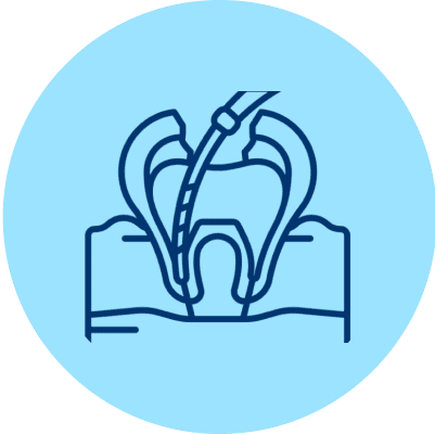Saving Your Tooth