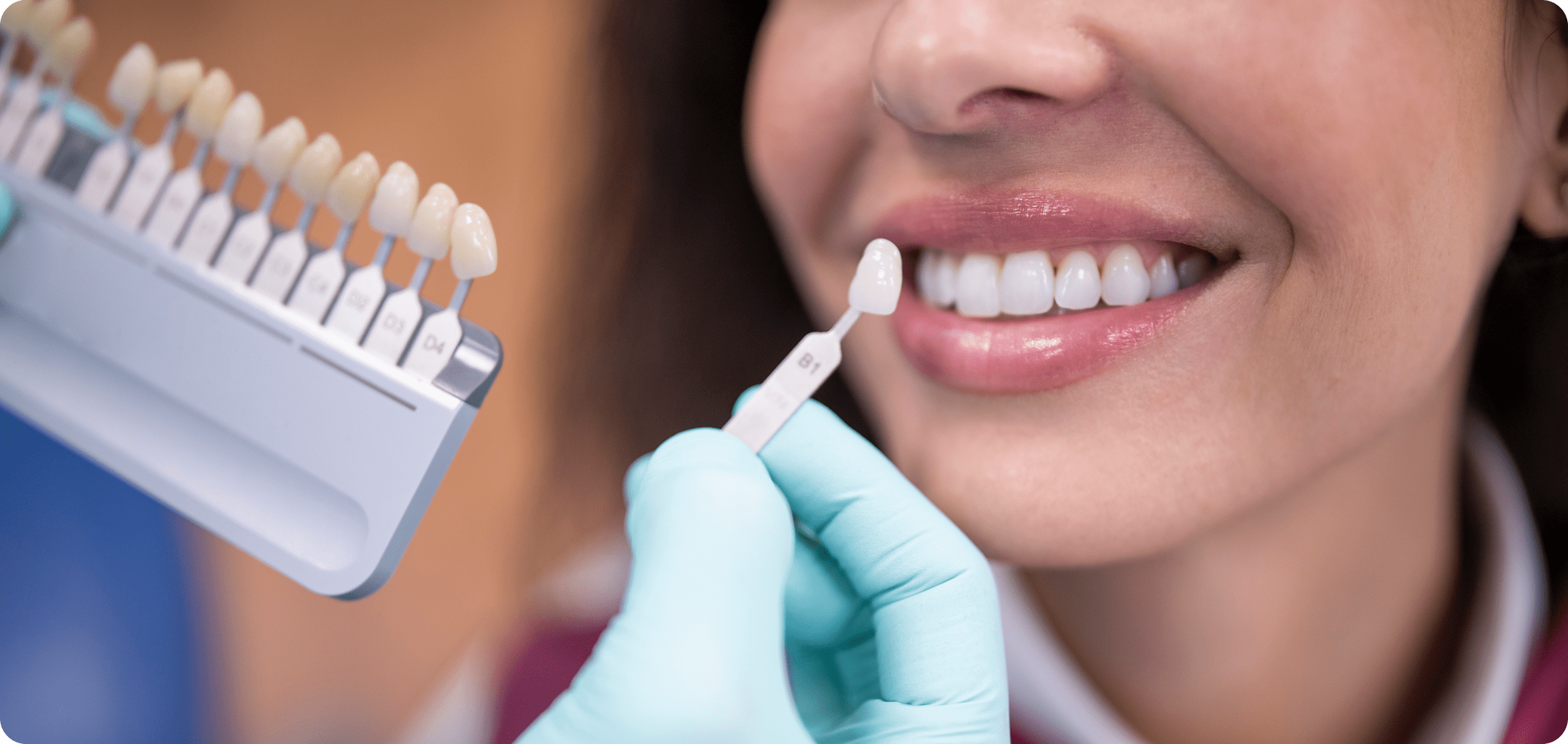 Dentist matching tooth shade with samples.