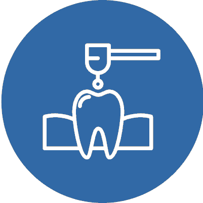 Restoring Your Teeth